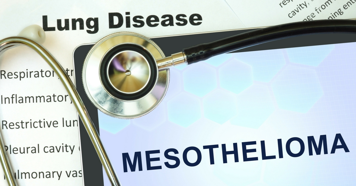 Mesothelioma-Asbestos-Injury-Lawyer-in-California